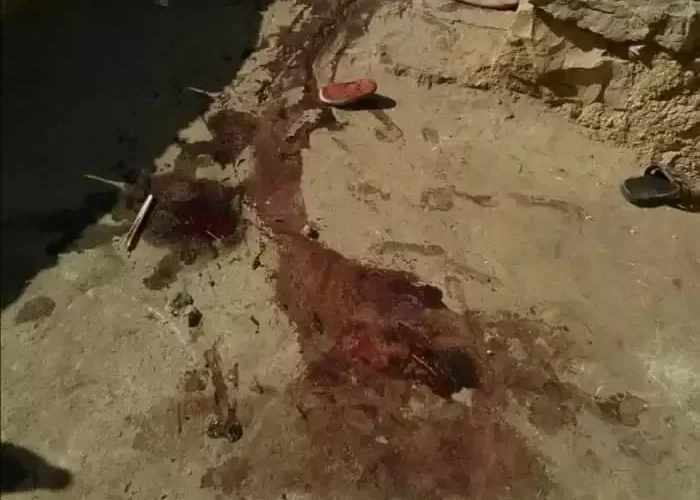 يمني يقتل زوجته بطريقة مروعة لسبب صادم