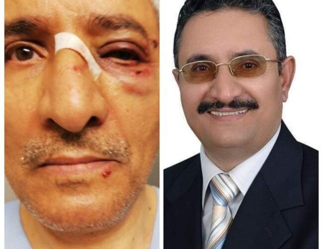 المفوضية الدولية للسلام تدين الاعتداء الوحشي على مسؤول مهم بالرئاسة اليمنية في سويسرا