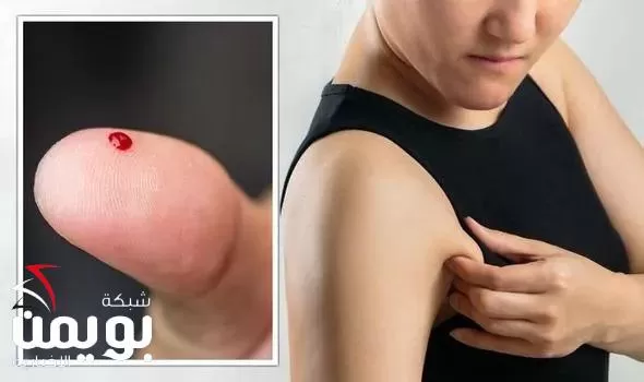 علامة في منطقة حساسة من الجسم تدل على ارتفاع قاتل في مستويات السكري يجب عليك التركيز عليها وفحصها دائماً