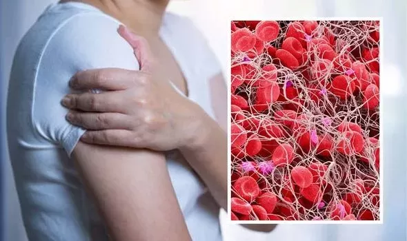 علامات على ذراعك تظهر بوضوح بدء تكون الجلطات القاتلة وهذه اول خطوة يجب عليك القيام بها لانقاذ حياتك