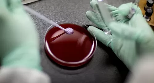 عشرة حالات تسبب تجلط الدم