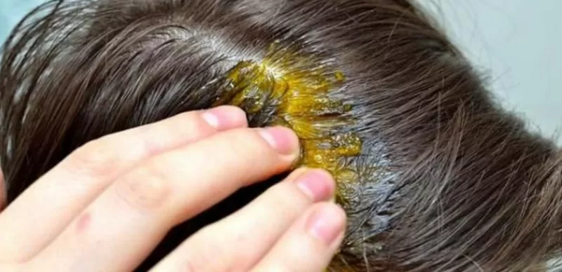 مسحوق القرنفل والنزنجبيل له مفعول يغير حياتك عندما تضعه على هذه المناطق الحساسة من جسدك والنتيجة ستدهشك