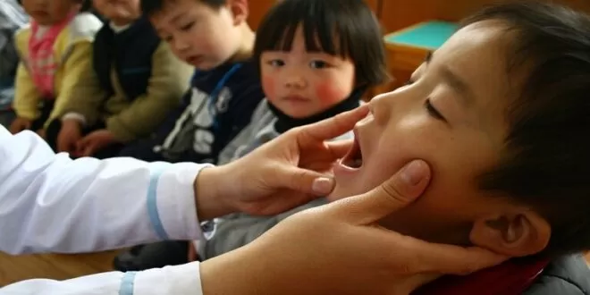 هذه الأمراض هي سبب هذه العلامات على الفم واللثة