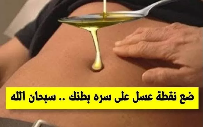 سبحان الله.. ضع نقطه من العسل علي السره فكره جهنميه ولا الجن الازرق يعرفها جربها لمدة 7 أيام وشاهد ماذا سيحدث لك !!