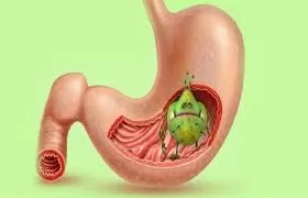 طرق الحماية من جرثومة المعدة