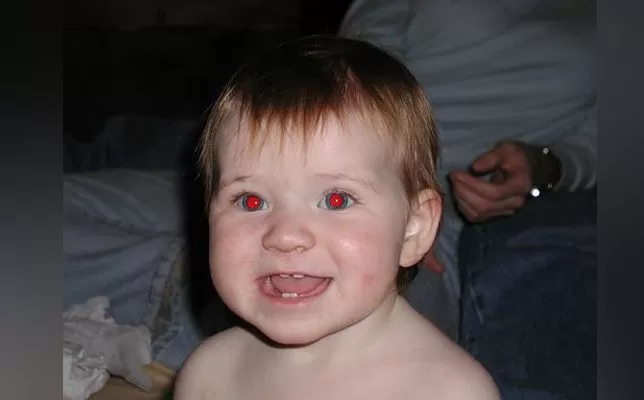 لهذا السبب تظهر عيون الناس حمراء في الصور