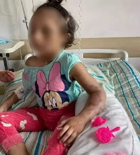 المملكة تشتعل بعد تسريب تفاصيل تعذيب طفلة بالجلد والحرق على يد والدتها لسبب غريب