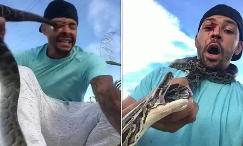شاهد ثعبان ضخم يغرز أنيابه في وجه شخص حاول الاستعراض به أمام الكاميرا