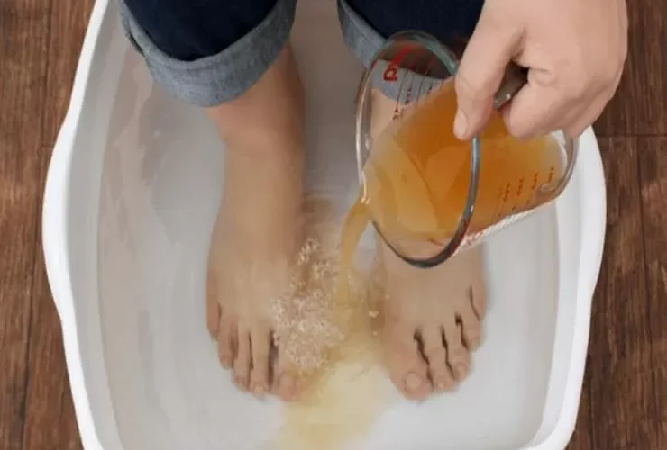 انقع قدميك داخل إناء فيه الخل والملح لمدة 15 دقيقة فقط.. وشاهد النتيجة المذهلة ” معجزة ربانية “