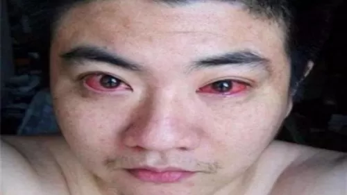 احذرها..أخطاء قام بها قبل النوم فأصيب بسرطان العين