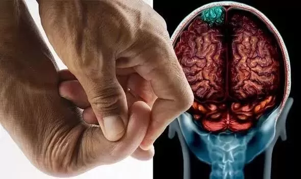 احذر .. إذا ظهرت هذه العلامات علي أقدامك فإنها تنبهك بوجود ورم خبيث في الدماغ.. انتبه منها فإنها خطر يهدد حياتك .. تعرف عليها !