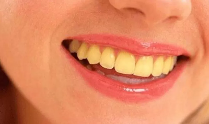 علامات تظهر اثناء استخدام فرشاة تنظيف الأسنان تدل على نقص حاد في فيتامين b12